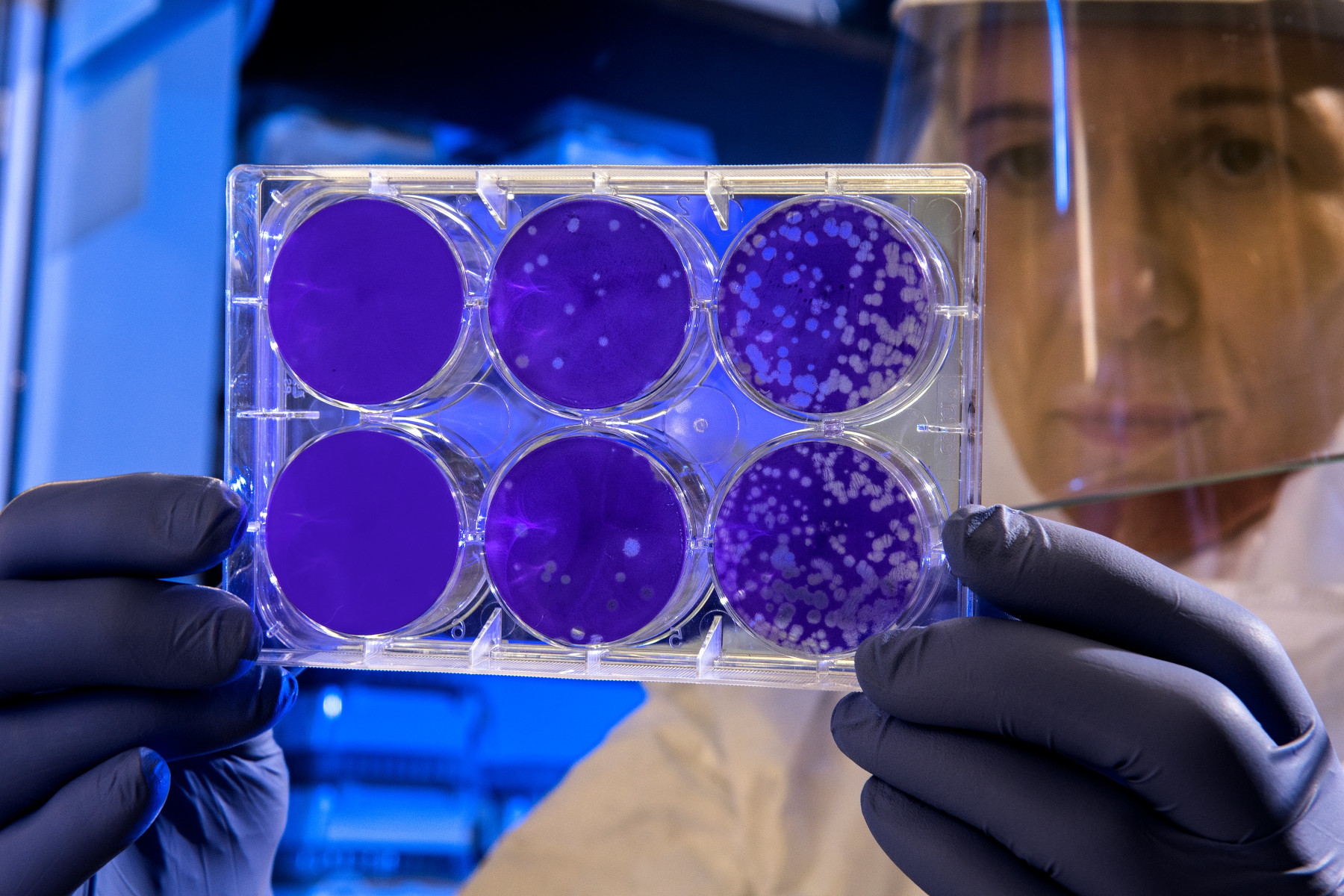 Dr. Benjamin Neuman: What The Coronavirus Does to Your Body That Makes It So Deadly